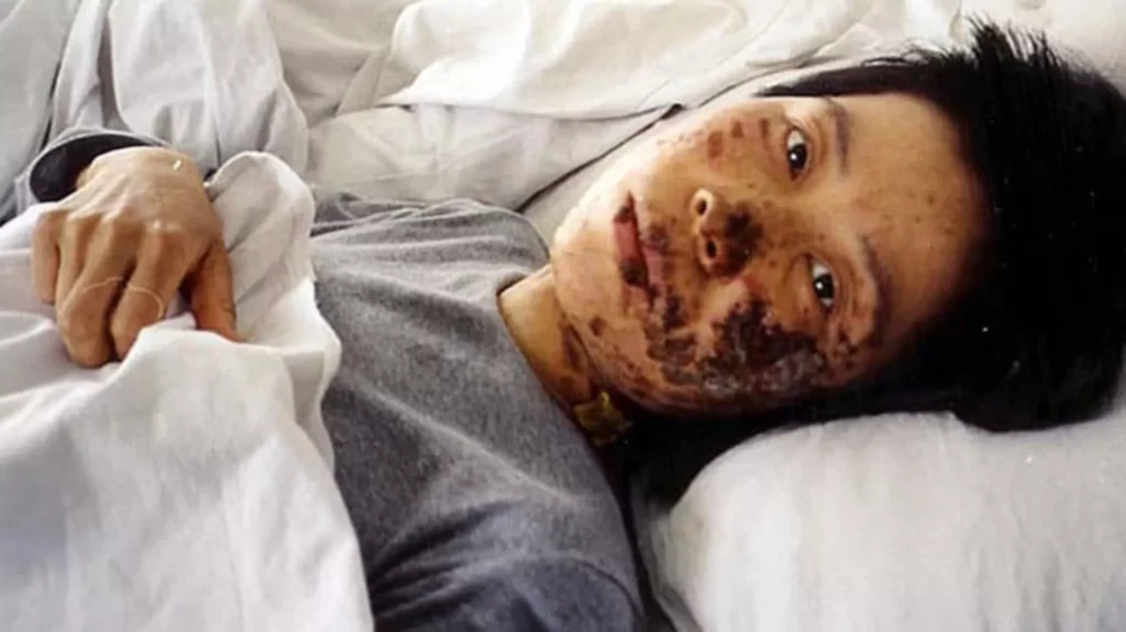 Lính canh đã sốc điện vào mặt cô Cao Dung Dung bằng dùi cui điện trong hơn 7 giờ. Cô đã qua đời ở tuổi 37