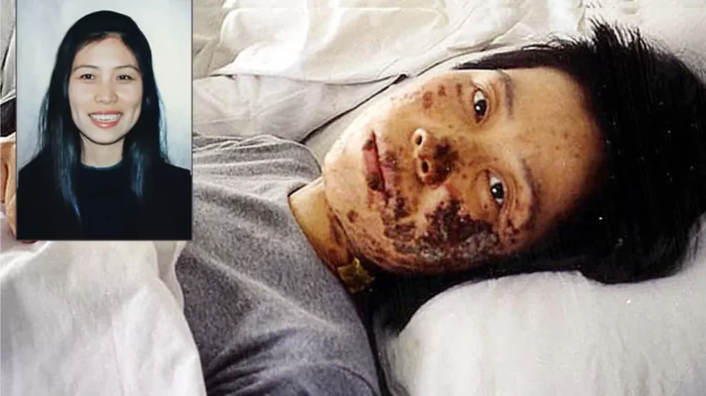 Tra tấn học viên Pháp Luân Công bằng dùi cui điện áp cao