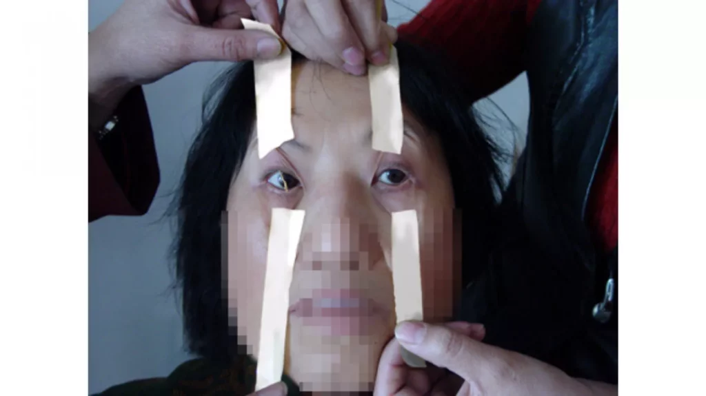 Tra tấn học viên Pháp Luân Công bằng cách dán băng dính để học viên không ngủ được