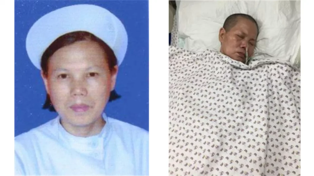 Bà Hạ Tường Cô, một cựu y tá bị bắt vì tu luyện Pháp Luân Công. Hình ảnh trước khi bị bức hại và sau khi bà bị tra tấn đến hôn mê sâu chưa tỉnh